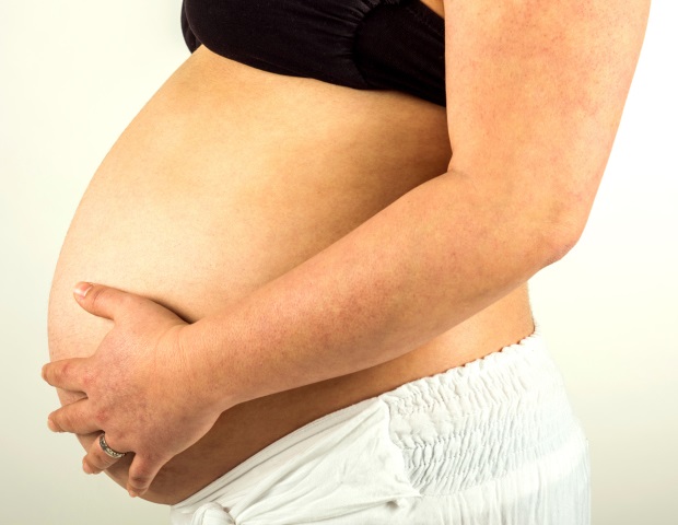 Obese pregnant women have greater risk of experiencing early and late-onset hypertensive disorders