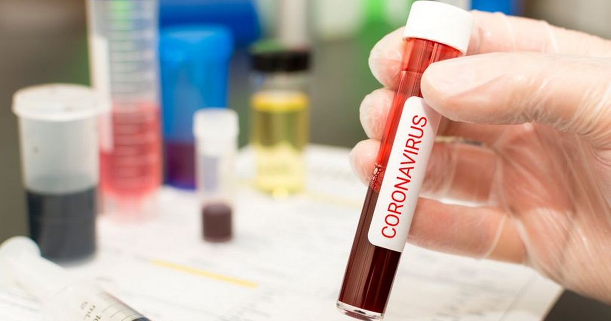Coronavirus in Ireland: 814 new infections and two deaths confirmed