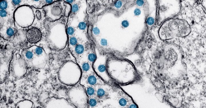 Coronavirus: Another 81 cases announced for the Inland Health District - Okanagan