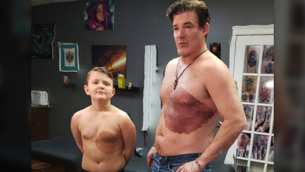 Dad gets a huge tattoo similar to a son's birthmark on his chest