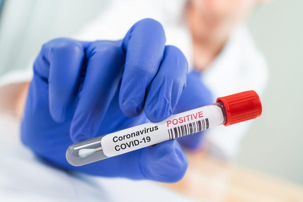 The decline in new coronavirus cases in some Midwestern states is giving signs of hope