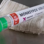 Argentina confirms first case of monkeypox in Latin America |  health
