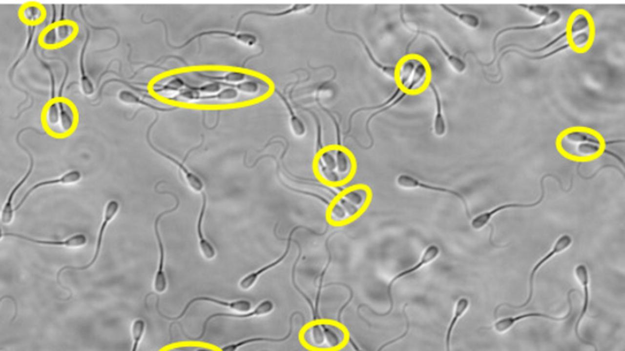 A sperm cell in the "peloton" has a greater chance of success than a solo swimmer |  Sciences